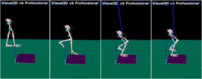 Effects of visual deprivation on the injury of lower extremities among functional ankle instability patients during drop landing: A kinetics perspective